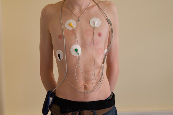 Langzeit-EKG-Messung